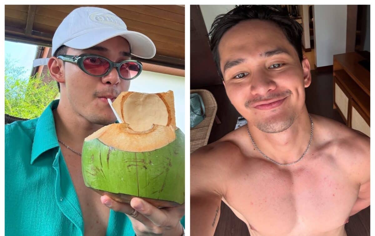 Doktor nagulat sa mabilis na 'healing' ni Ruru Madrid pero may babala